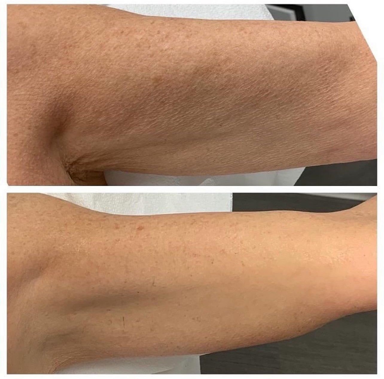 Epicutis Lipid Body Treatment | Free Gift With Purchase