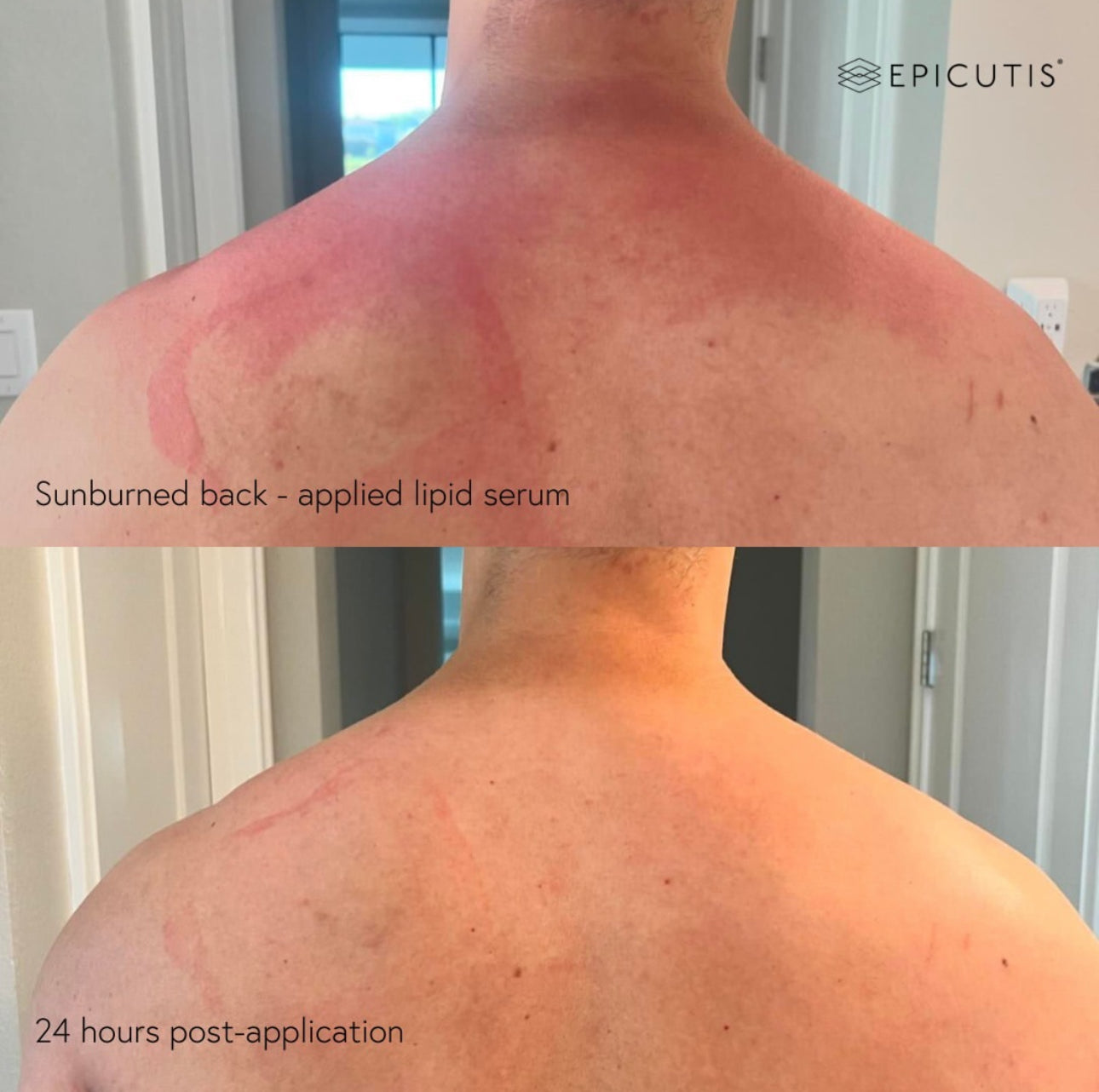 Epicutis Lipid Serum | Free Gift With Purchase