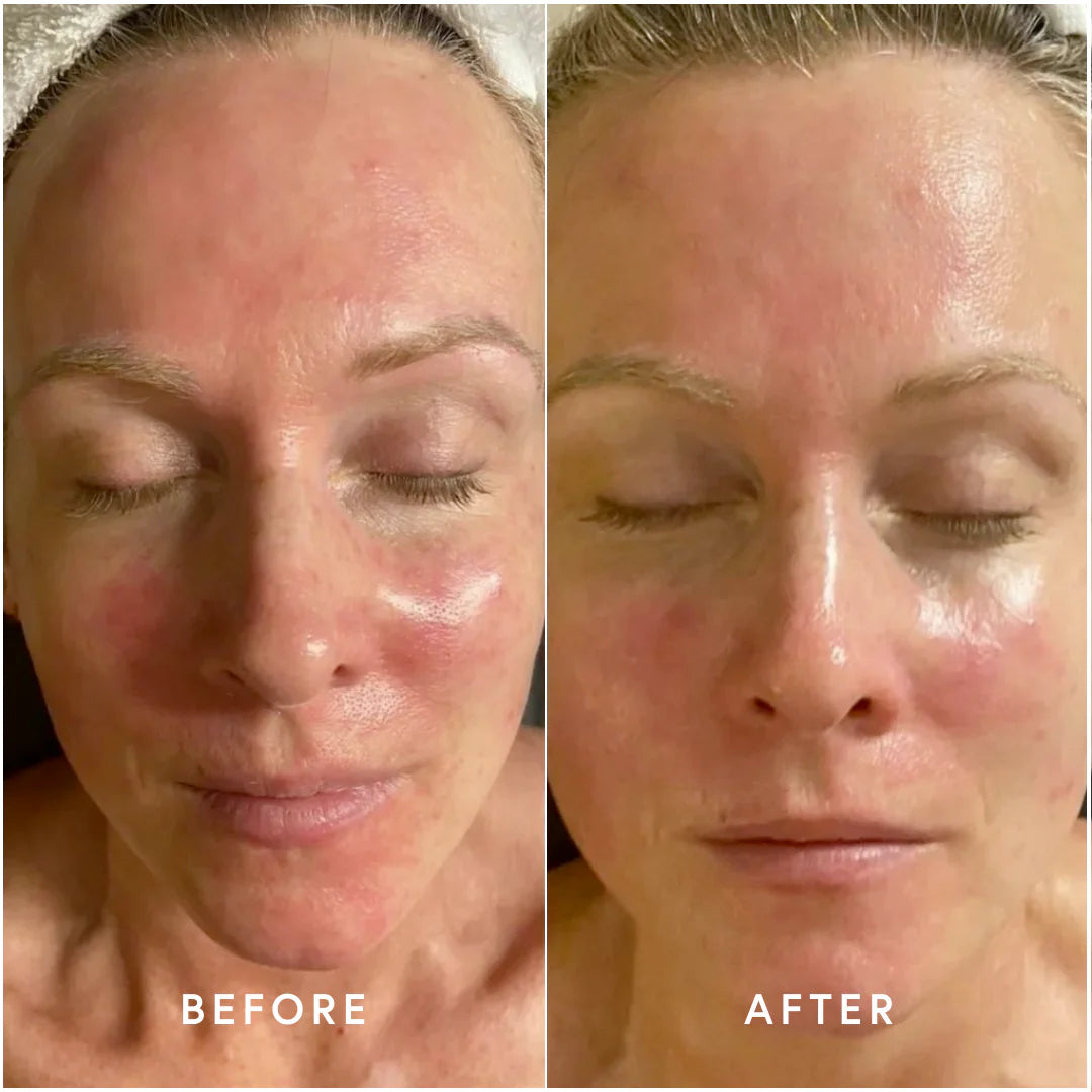 Epicutis Oil Cleanser | Free Gift With Purchase